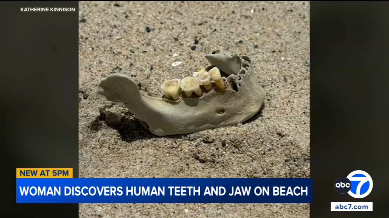 Woman finds human jawbone with teeth on California beach
